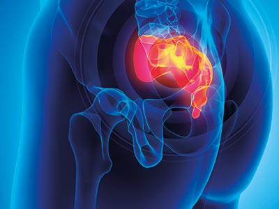 Συμπτώματα Κύστης Κόκκυγος