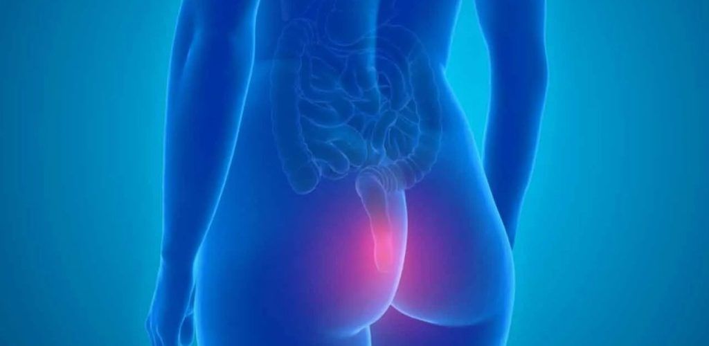 επέμβαση αιμορροΐδων laser