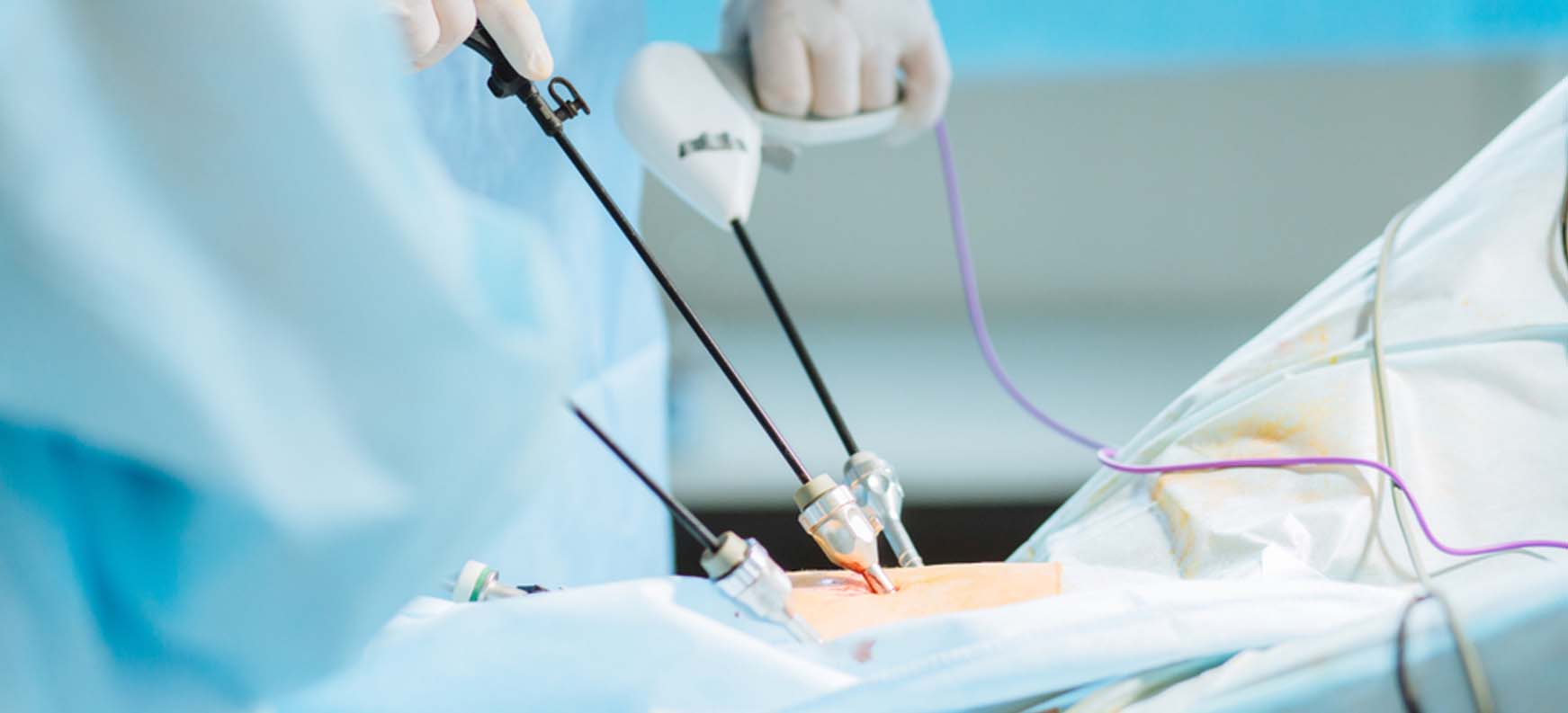 Εγχείρηση Χολής Χωρίς Επιπλοκές